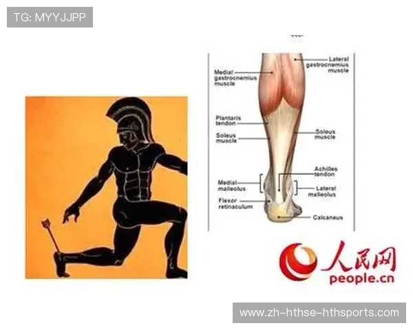 足球跟腱康复过程中的关键技术和注意事项